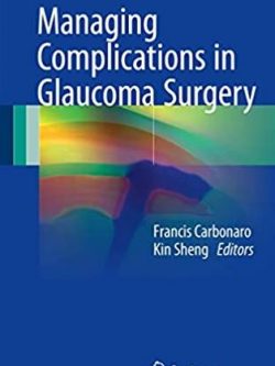 Managing Complications in Glaucoma Surgery Francis Carbonaro, ISBN-13: 978-3319494142