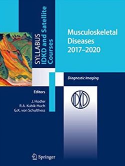 Musculoskeletal Diseases 2017-2020: Diagnostic Imaging Juerg Hodler, ISBN-13: 978-3319540191