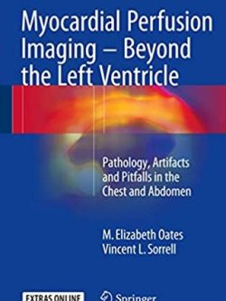 Myocardial Perfusion Imaging – Beyond the Left Ventricle M. Elizabeth Oates, ISBN-13: 978-3319254340