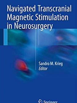 Navigated Transcranial Magnetic Stimulation in Neurosurgery Sandro M. Krieg, ISBN-13: 978-3319549170