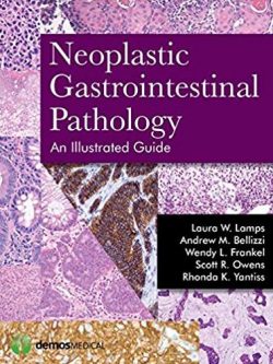 Neoplastic Gastrointestinal Pathology: An Illustrated Guide, ISBN-13: 978-1936287727