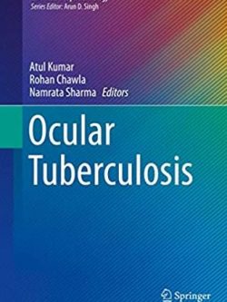 Ocular Tuberculosis 2017 Edition Atul Kumar, ISBN-13: 978-3319575193