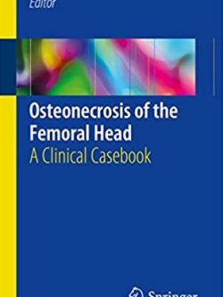 Osteonecrosis of the Femoral Head: A Clinical Casebook Rafael J. Sierra, ISBN-13: 978-3319506630