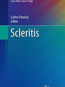 Scleritis (Essentials in Ophthalmology) 2017 Edition Carlos Pavesio, ISBN-13: 978-3319499130