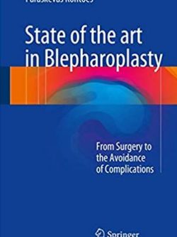 State of the art in Blepharoplasty: From Surgery to the Avoidance of Complications, ISBN-13: 978-3319526416