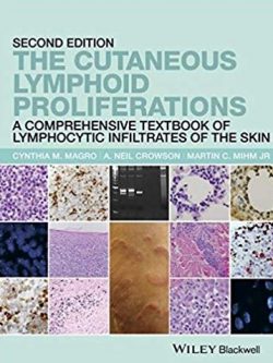 The Cutaneous Lymphoid Proliferations: A Comprehensive Textbook of Lymphocytic Infiltrates of the Skin 2nd Edition, ISBN-13: 978-1118776261