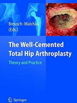 The Well-Cemented Total Hip Arthroplasty: Theory and Practice, ISBN-13: 978-3540241973