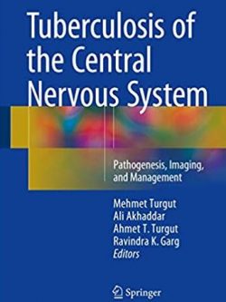 Tuberculosis of the Central Nervous System Mehmet Turgut, ISBN-13: 978-3319507118