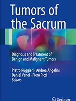 Tumors of the Sacrum: Diagnosis and Treatment of Benign and Malignant Tumors, ISBN-13: 978-3319512006