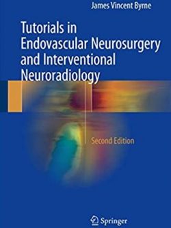 Tutorials in Endovascular Neurosurgery and Interventional Neuroradiology 2nd Edition, ISBN-13: 978-3319548333