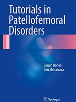 Tutorials in Patellofemoral Disorders Iain McNamara, ISBN-13: 978-3319474014