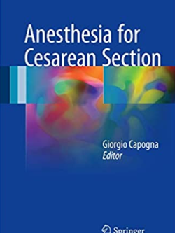 Anesthesia for Cesarean Section Giorgio Capogna, ISBN-13: 978-3319420516