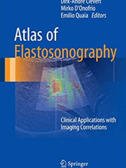 Atlas of Elastosonography: Clinical Applications with Imaging Correlations, ISBN-13: 978-3319441993