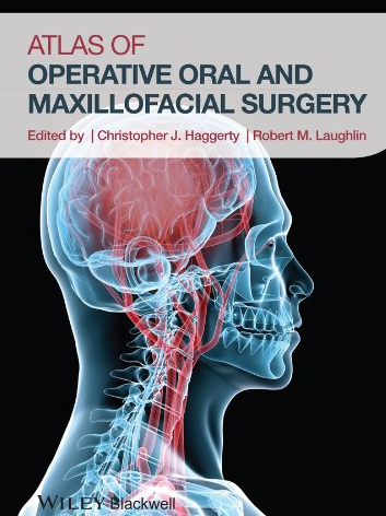 Atlas of Operative Oral and Maxillofacial Surgery 1st Edition, ISBN-13: 978-1118442340