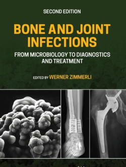 Bone and Joint Infections: From Microbiology to Diagnostics and Treatment 2nd Edition, ISBN-13: 978-1119720652