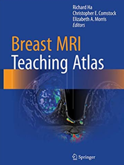 Breast MRI Teaching Atlas 2017 Edition by Richard Ha, ISBN-13: 978-1493964079