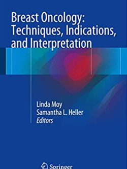 Breast Oncology: Techniques, Indications, and Interpretation Samantha L. Heller, ISBN-13: 978-3319425610