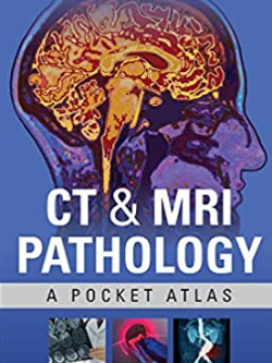 CT & MRI Pathology: A Pocket Atlas 3rd Edition by Michael Grey, ISBN-13: 978-1260121940