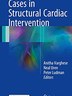 Cases in Structural Cardiac Intervention Anitha Varghese, ISBN-13: 978-1447149804