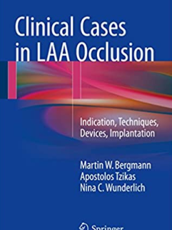 Clinical Cases in LAA Occlusion: Indication, Techniques, Devices, Implantation, ISBN-13: 978-3319514307