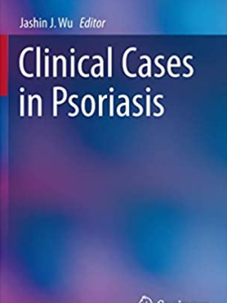 Clinical Cases in Psoriasis 1st Edition by Jashin J. Wu, ISBN-13: 978-3319527789