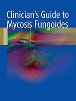 Clinician’s Guide to Mycosis Fungoides 2017 Edition, ISBN-13: 978-3319479064