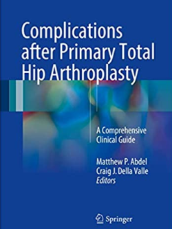 Complications after Primary Total Hip Arthroplasty: A Comprehensive Clinical Guide, ISBN-13: 978-3319549118