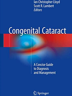 Congenital Cataract: A Concise Guide to Diagnosis and Management, ISBN-13: 978-3319278469