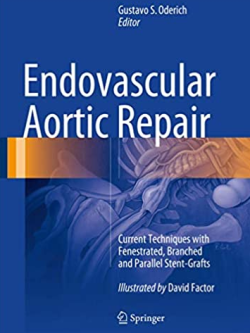 Endovascular Aortic Repair by Gustavo S. Oderich, ISBN-13: 978-3319151915