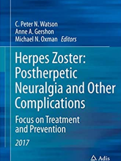 Herpes Zoster: Postherpetic Neuralgia and Other Complications, ISBN-13: 978-3319443461