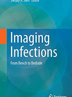 Imaging Infections: From Bench to Bedside 1st Edition Sanjay K. Jain, ISBN-13: 978-3319854335