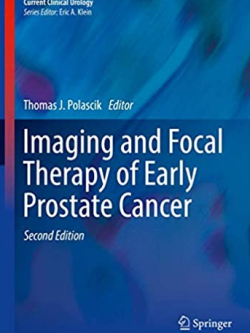 Imaging and Focal Therapy of Early Prostate Cancer 2nd Edition Thomas J. Polascik, ISBN-13: 978-3319499109