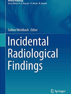 Incidental Radiological Findings Sabine Weckbach, ISBN-13: 978-3319425795